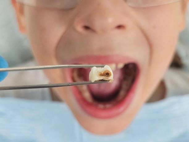 Best Emergency Dental Care for Trauma or Injury in East Oakdale, CA